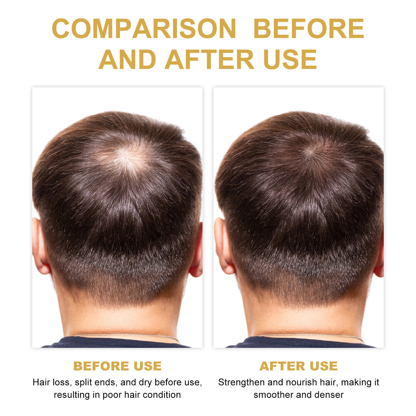 Eelhoe Growth OilHNGoods