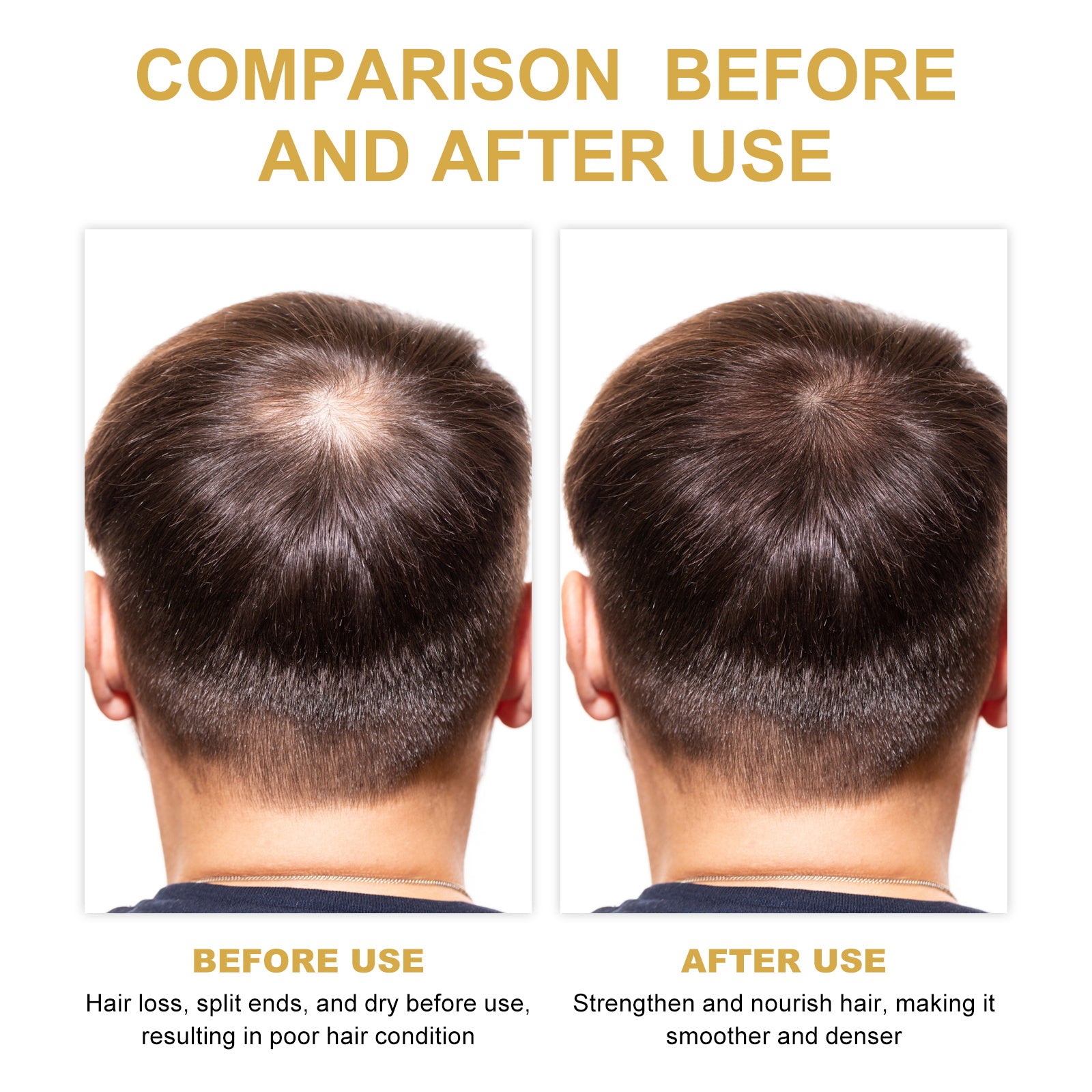 Eelhoe Growth OilHNGoods